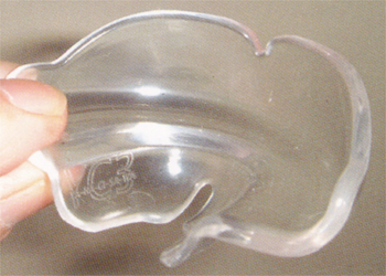 マウスピースによる歯列矯正について｜渡辺歯科