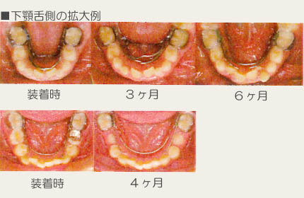 顎顔面矯正治療｜渡辺歯科