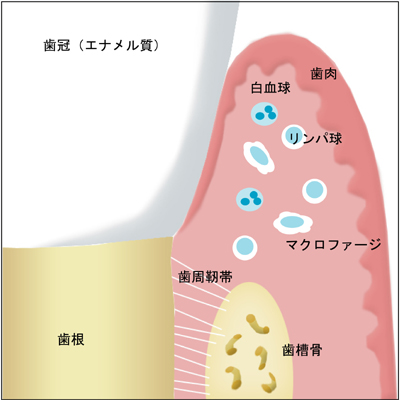 口腔内の免疫機能　歯周治療について｜渡辺歯科