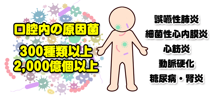 口腔内細菌の全身への影響について