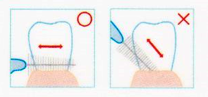 歯間ブラシの注意点