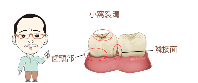 口腔内細菌の全身への影響について